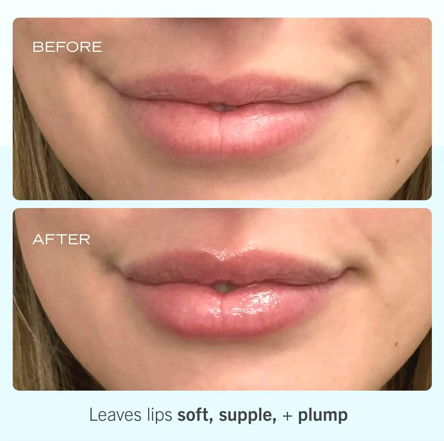 Ultra Repair Lip Balm - Moisturizes Lippen