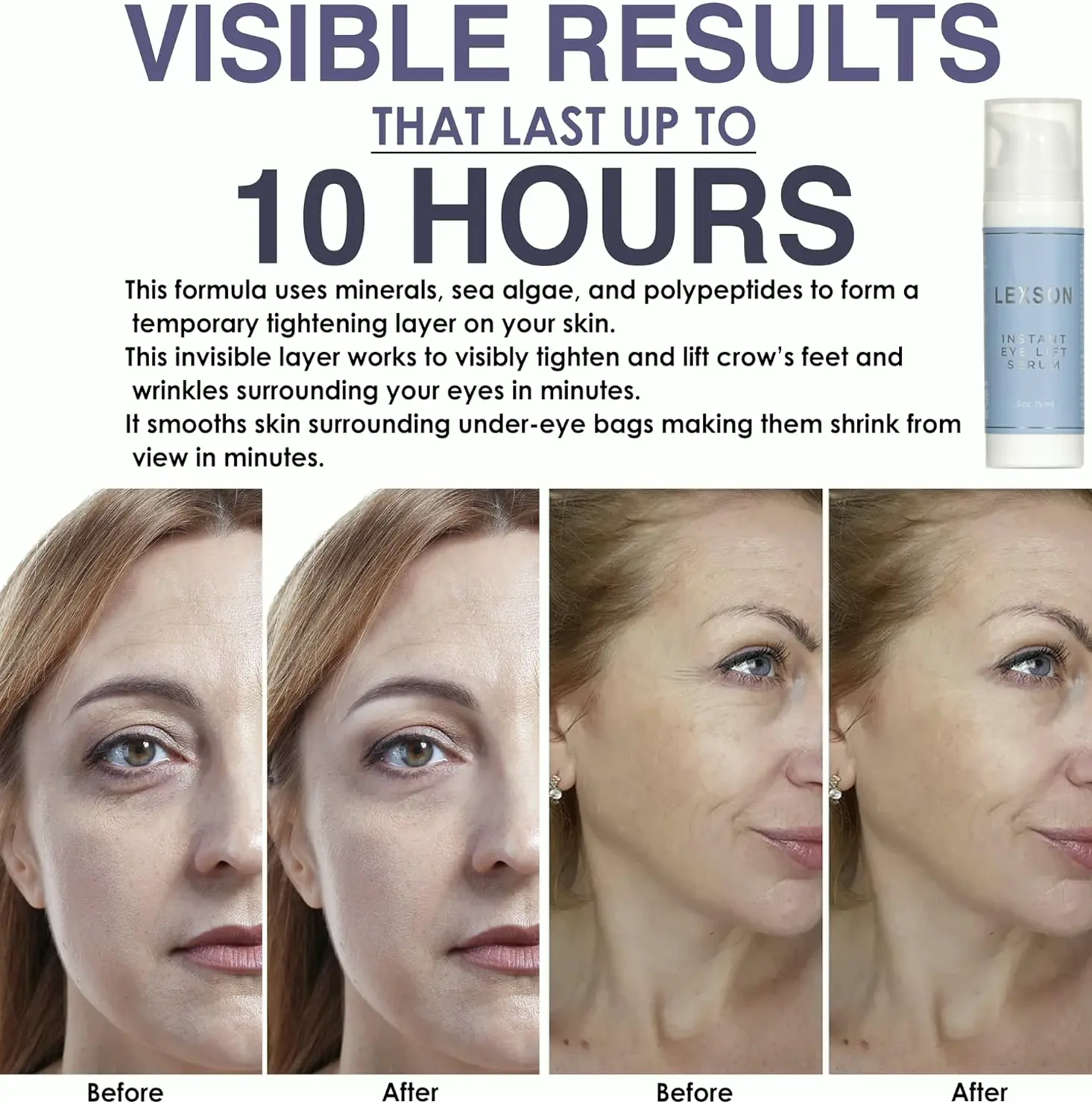 Instant Eye Lift Serum - Immediate Results for Lines & Wrinkles