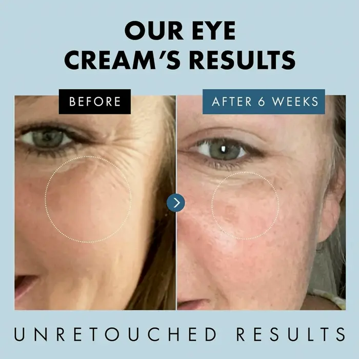 Under Eye Gel for Puffiness